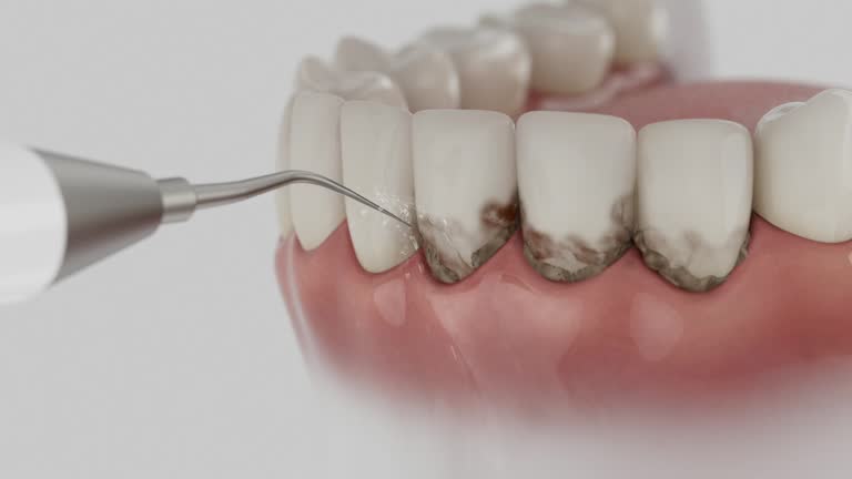 Reliable Dental contractor in Elida, OH by Smile Center Dentistry